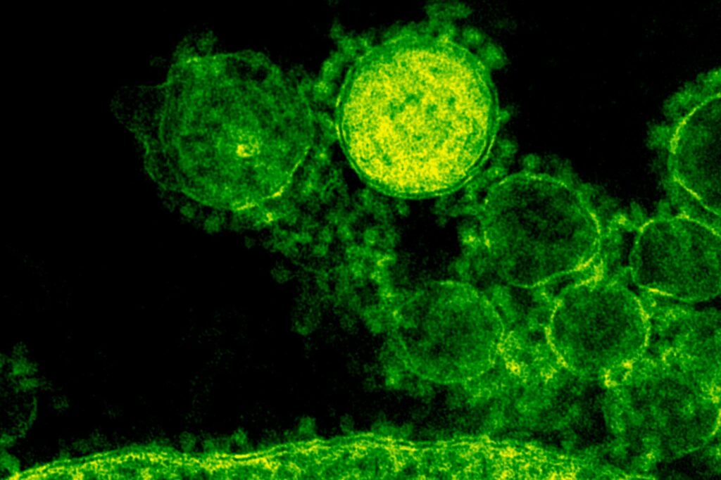 Autoimmune Diseases